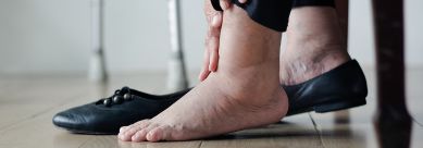 What Causes Swollen Legs and Feet? Understanding the Root Causes