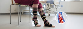 Dr. Johnny's surgeon-designed graduated compression socks, worn to help ease leg and ankle swelling